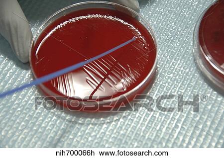 Staphylococcus Bacteria from human skin grown on agar. View Large Photo Image Stock Image - Staphylococcus Bacteria from human skin grown on agar.. Fotosearch