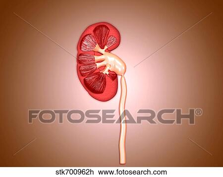 Drawing - Ureteropelvic junction (UPJ) obstruction in the kidney.. Fotosearch