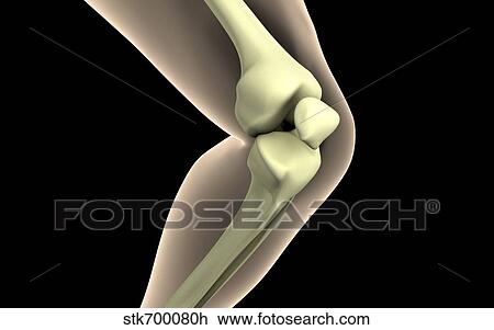 Drawing - X-ray image of knee.. Fotosearch