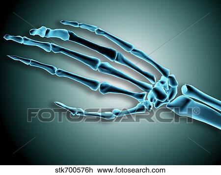 X-ray view of bones in human hand. View Large Illustration Drawing - X-ray view of bones in human hand.. Fotosearch