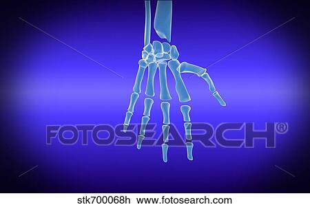 Drawing - X-ray view of human hand.. Fotosearch