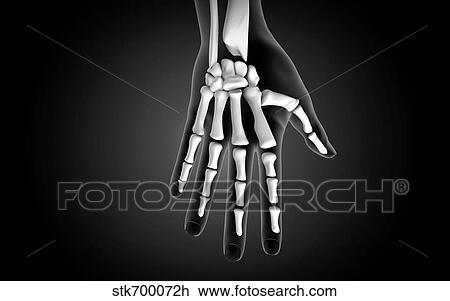 X-ray view of human hand. View Large Illustration Drawing - X-ray view of human hand.. Fotosearch