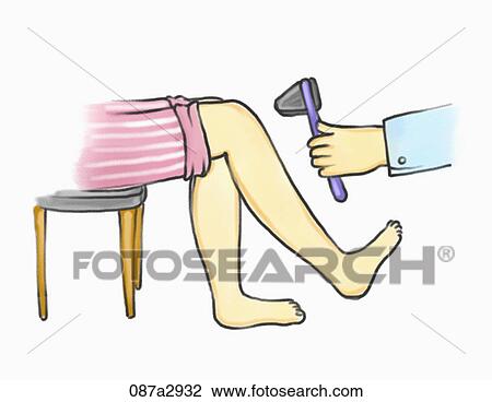 Drawing - Illustration of a doctor checking patient's leg. Fotosearch