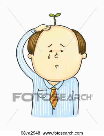 Illustration of a man with hair loss View Large Illustration Stock Illustration - Illustration of a man with hair loss. Fotosearch