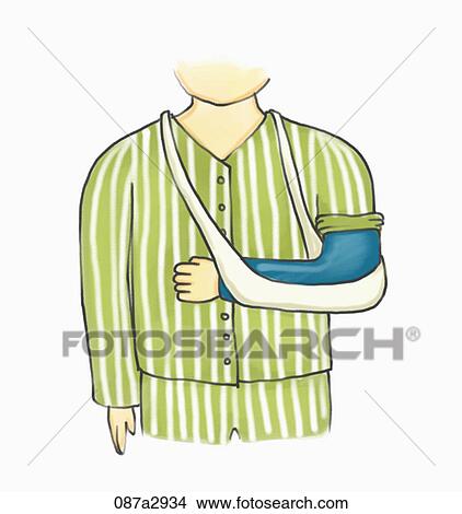 Stock Illustration - Illustration of a patient with broken arm. Fotosearch