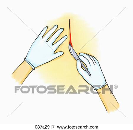 Illustration of act of cutting a skin View Large Illustration Stock Illustration - Illustration of act of cutting a skin. Fotosearch