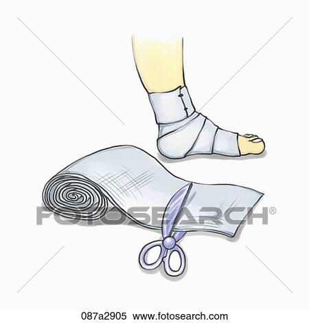 Illustration of ankle with bandage View Large Illustration Stock Illustration - Illustration of ankle with bandage. Fotosearch