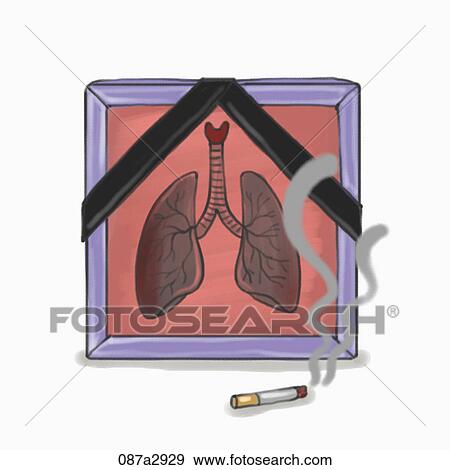 Illustration of lung and a cigarette View Large Illustration Stock Illustration - Illustration of lung and a cigarette. Fotosearch