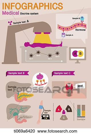 illustration of medical info graphics related to doctrine system View Large Illustration Clipart - illustration of medical info graphics related to doctrine system. Fotosearch