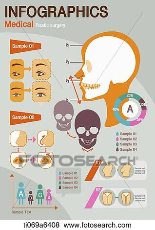 illustration of medical info graphics related to plastic surgery View Large Illustration Stock Illustration - illustration of medical info graphics related to plastic surgery. Fotosearch