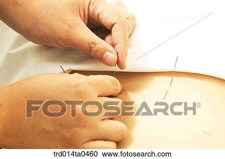 person, needle, Oriental medicine, Oriental, Oriental culture, Oriental medicine, traditional medicine View Large Photo Image Stock Image - person, needle, Oriental medicine, Oriental, Oriental culture, Oriental medicine, traditional medicine. Fotosearch