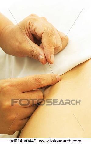 person, needle, Oriental medicine, Oriental, Oriental culture, Oriental medicine, traditional medicine View Large Photo Image Stock Photo - person, needle, Oriental medicine, Oriental, Oriental culture, Oriental medicine, traditional medicine. Fotosearch