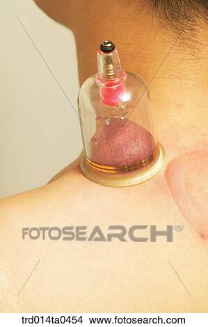 person, Oriental medicine, Oriental, Oriental culture, Oriental medicine, traditional medicine, tradition View Large Photo Image Picture - person, Oriental medicine, Oriental, Oriental culture, Oriental medicine, traditional medicine, tradition. Fotosearch