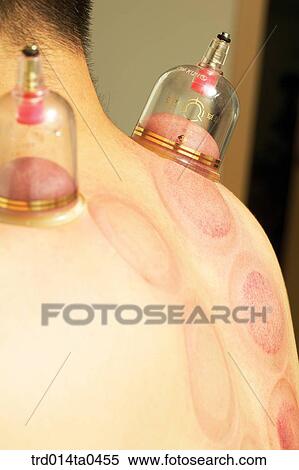 Stock Photography - person, Oriental medicine, Oriental, Oriental culture, Oriental medicine, traditional medicine, tradition. Fotosearch