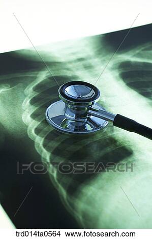 medical treatment, medicine, X-ray, X-rayphotograph, x-ray, stethoscope, X-ray film View Large Photo Image Picture - medical treatment, medicine, X-ray, X-rayphotograph, x-ray, stethoscope, X-ray film. Fotosearch