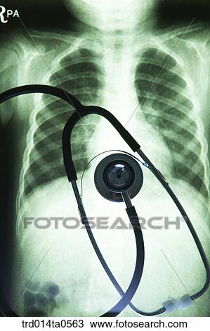 medical treatment, medicine, X-ray, X-rayphotograph, x-ray, stethoscope, X-ray film View Large Photo Image Stock Image - medical treatment, medicine, X-ray, X-rayphotograph, x-ray, stethoscope, X-ray film. Fotosearch