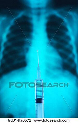 medical treatment, medicine, X-ray, X-rayphotograph, x-ray, syringe, injection View Large Photo Image Stock Image - medical treatment, medicine, X-ray, X-rayphotograph, x-ray, syringe, injection. Fotosearch