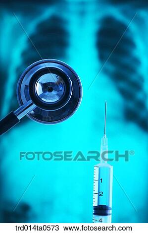 Stock Image - medical treatment, medicine, X-ray, X-rayphotograph, x-ray, syringe, injection. Fotosearch