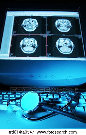 medical treatment, medicine, X-ray, dislocation, dislocation photograph, dislocation, close up View Large Photo Image Stock Photo - medical treatment, medicine, X-ray, dislocation, dislocation photograph, dislocation, close up. Fotosearch
