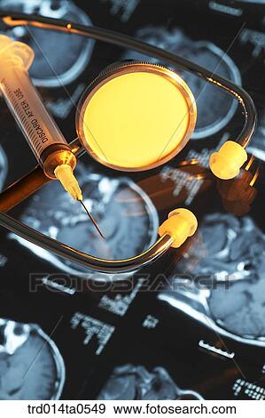 medical treatment, medicine, X-ray, dislocation, dislocation photograph, dislocation, close up View Large Photo Image Stock Photo - medical treatment, medicine, X-ray, dislocation, dislocation photograph, dislocation, close up. Fotosearch