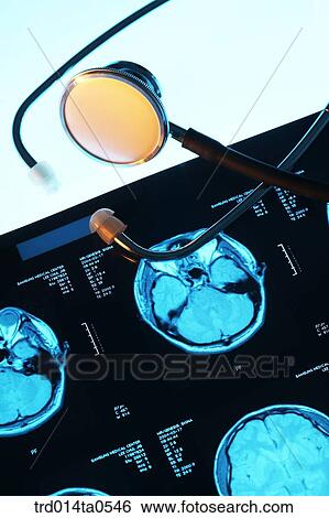 medical treatment, medicine, X-ray, dislocation, dislocation photograph, dislocation, close up View Large Photo Image Stock Photograph - medical treatment, medicine, X-ray, dislocation, dislocation photograph, dislocation, close up. Fotosearch