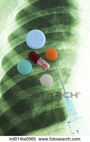 medical treatment, medicine, X-ray, X-rayphotograph, x-ray, pill, drug View Large Photo Image Stock Photography - medical treatment, medicine, X-ray, X-rayphotograph, x-ray, pill, drug. Fotosearch