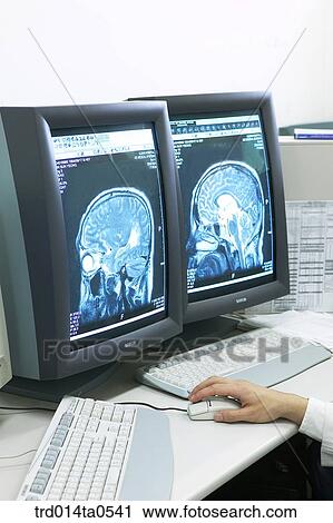 Stock Image - person, medical treatment, medicine, hand, monitor, dislocation, dislocation photograph. Fotosearch