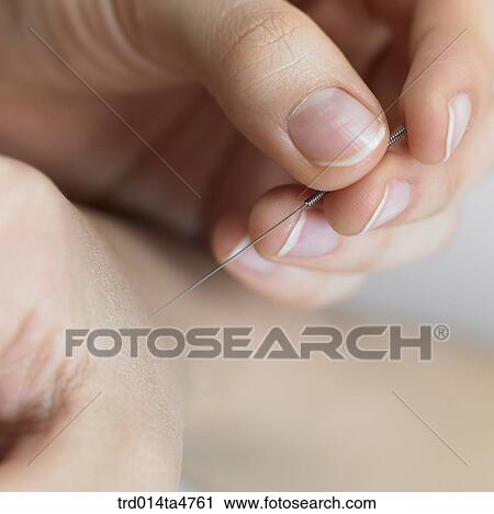 Chinese medicine oriental medicine/ hand applying accupunture on patient's hand View Large Photo Image Stock Image - Chinese medicine oriental medicine/ hand applying accupunture on patient's hand. Fotosearch