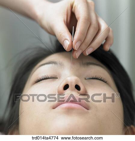 Chinese medicine oriental medicine/hand applying accupuntue on patient's face View Large Photo Image Picture - Chinese medicine oriental medicine/hand applying accupuntue on patient's face. Fotosearch
