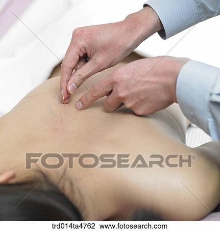 Chinese medicine oriental medicine/hand applying accupuntue on patient's back View Large Photo Image Stock Image - Chinese medicine oriental medicine/hand applying accupuntue on patient's back. Fotosearch