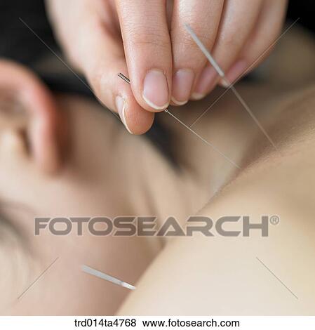 Chinese medicine oriental medicine/hand applying accupunture on patient's shoulder View Large Photo Image Stock Photo - Chinese medicine oriental medicine/hand applying accupunture on patient's shoulder. Fotosearch