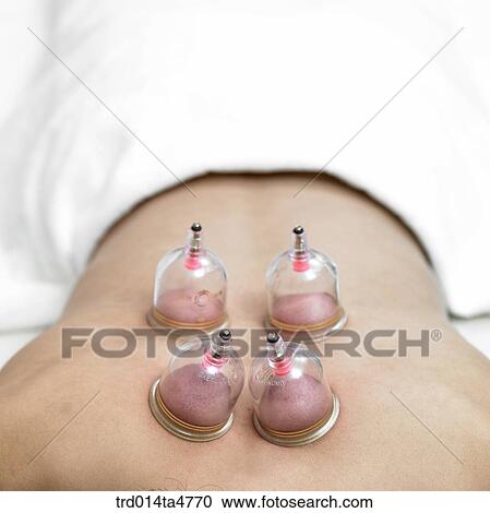 Chinese medicine oriental medicine/Chinese therapy View Large Photo Image Stock Image - Chinese medicine oriental medicine/Chinese therapy. Fotosearch