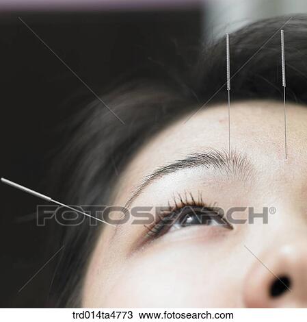 Chinese medicine oriental medicine/accupunture View Large Photo Image Stock Image - Chinese medicine oriental medicine/accupunture. Fotosearch