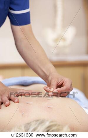 Acupuncturist treating female client View Large Photo Image Stock Image - Acupuncturist treating female client. Fotosearch
