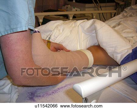 The doctor wrapping a cast. View Large Photo Image Stock Photograph - The doctor wrapping a cast.. Fotosearch