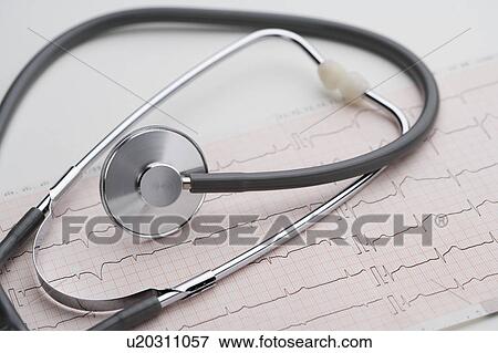 Stock Photo - A Stethoscope and an Electrocardiogram. Fotosearch