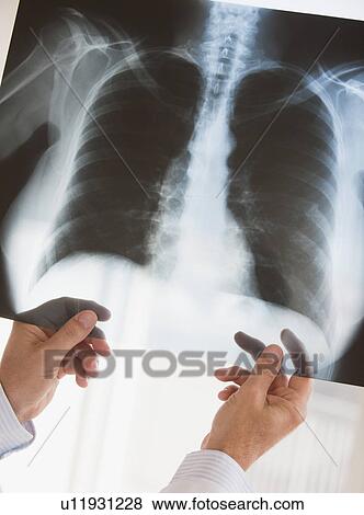Chest x-ray View Large Photo Image Stock Photo - Chest x-ray. Fotosearch