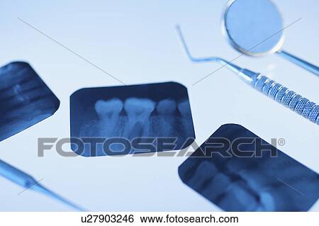 Stock Photograph - Dental instruments and x-rays. Fotosearch