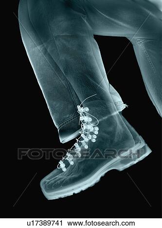 X-ray of leg and boot View Large Photo Image Stock Image - X-ray of leg and boot. Fotosearch