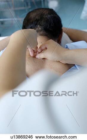 Young woman putting acupuncture needles on man's back View Large Photo Image Stock Photograph - Young woman putting acupuncture needles on man's back. Fotosearch