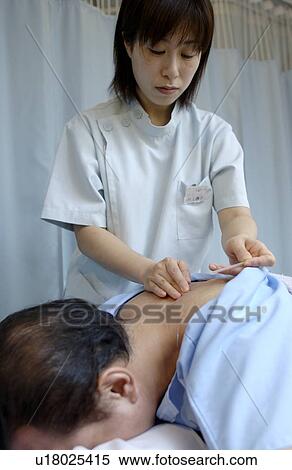Stock Photography - Young woman putting acupuncture needles on man's back. Fotosearch
