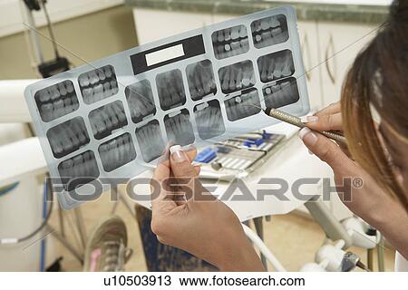 Stock Image - Dentist examining X-rays, (close-up). Fotosearch