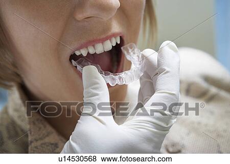 Stock Photo - Woman having dental mold fitted, (close-up). Fotosearch