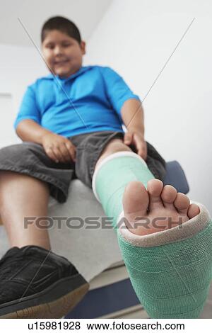 Stock Photo - Boy with leg in plaster cast. Fotosearch