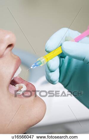 Stock Photo - Dentist inspecting patient's teeth. Fotosearch