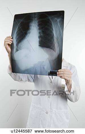 Stock Photo - Doctor with xray covering face. Fotosearch