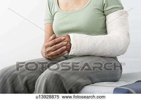 Senior woman sits with plastercast on broken arm, mid-section View Large Photo Image Stock Photography - Senior woman sits with plastercast on broken arm, mid-section. Fotosearch