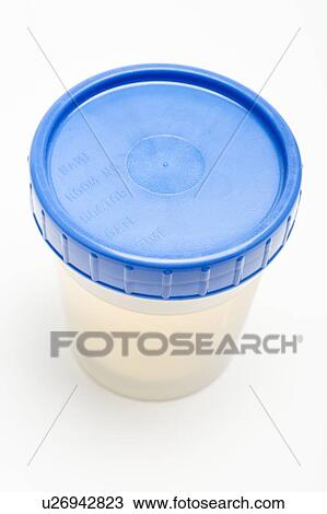 Stock Image - Urine sample in plastic pot. Fotosearch