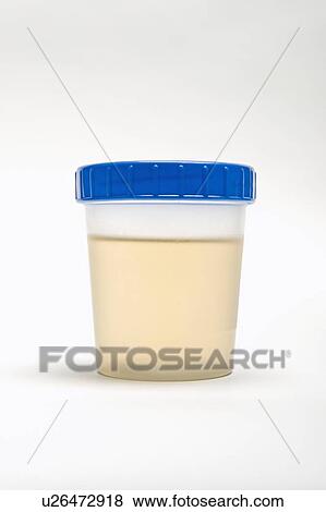 Urine sample in plastic pot View Large Photo Image Stock Photo - Urine sample in plastic pot. Fotosearch