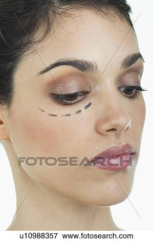 Stock Photo - Closeup of patient's face with distance marker. Fotosearch